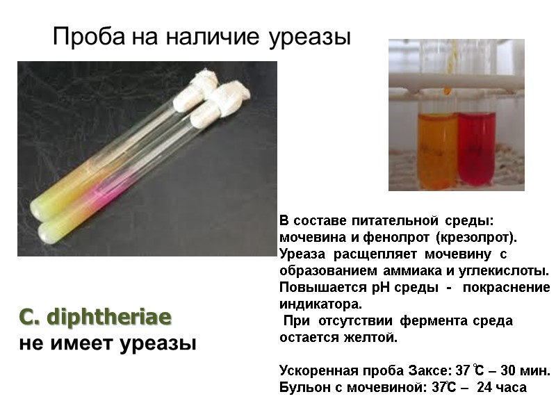 Проба на наличие уреазы C. diphtheriae  не имеет уреазы В составе питательной среды: